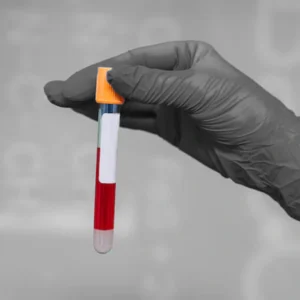 Dengue/ Platelet Count